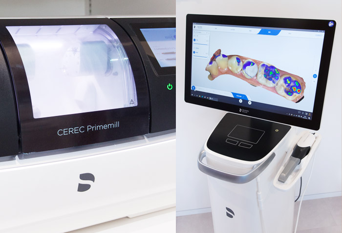 スキャナーやセレックシステムのイメージ