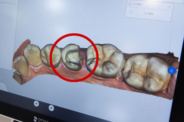 資料取り（写真・型取り）のイメージ