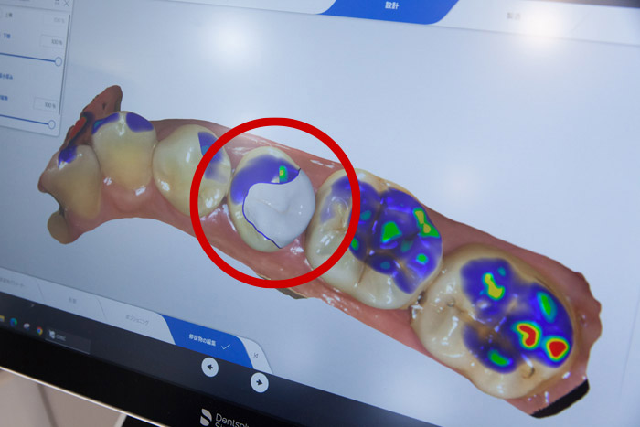 シミュレーションのイメージ